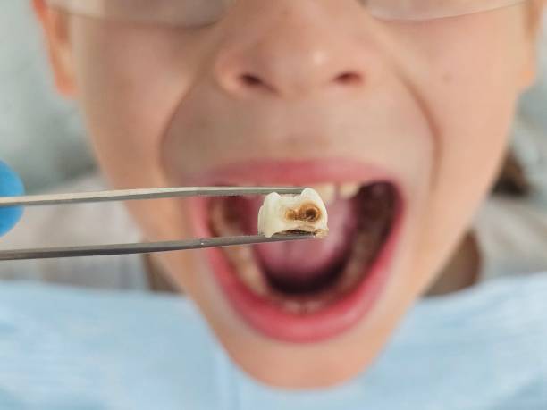 Best 24-Hour Emergency Dental Care in Farmland, IN